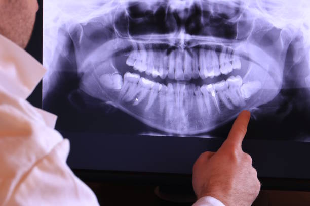 Best Weekend Emergency Dentist in Carson City, MI