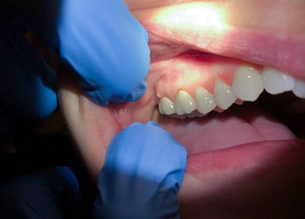 Best Weekend Emergency Dentist in Carson City, MI